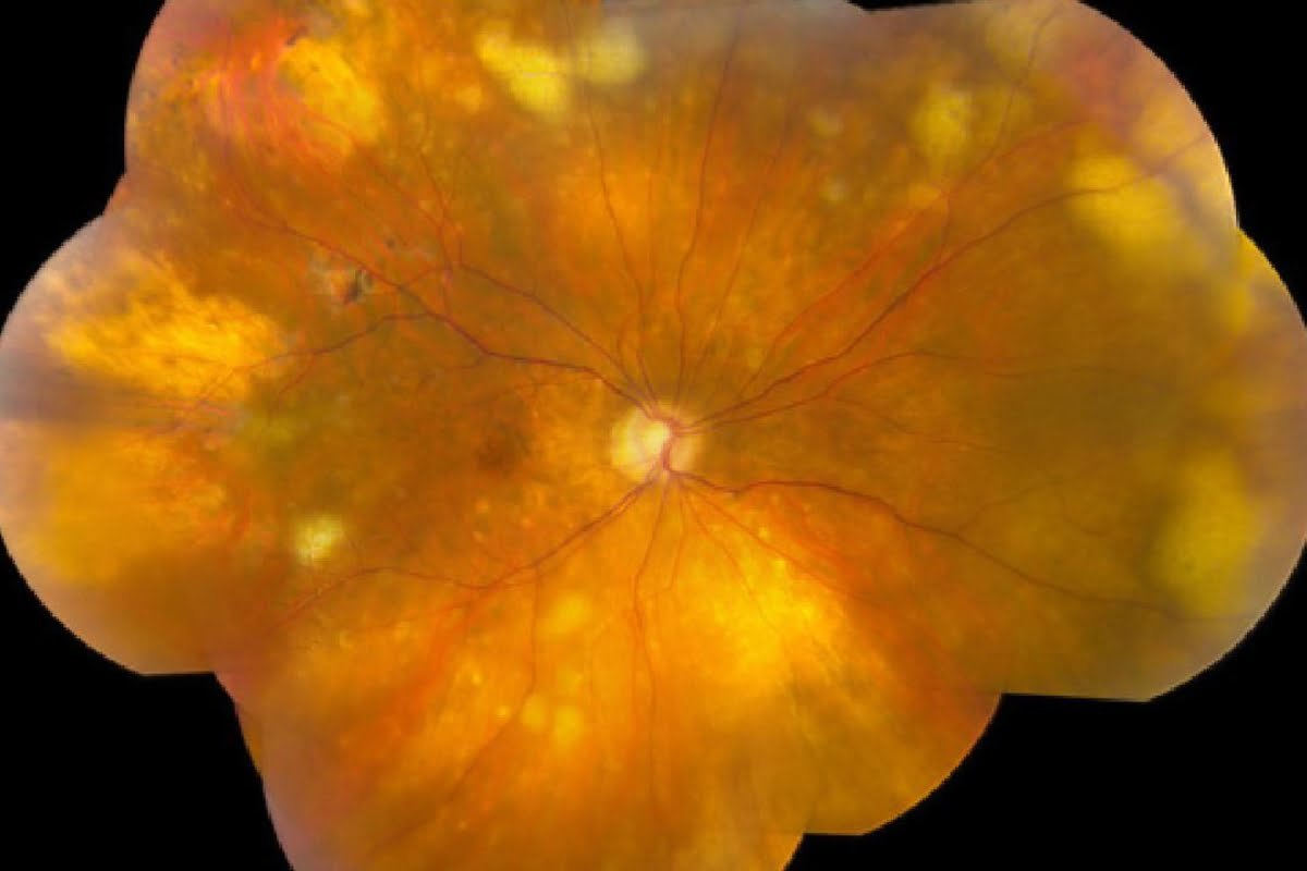 FDA rejects Aldeyra's eye cancer treatment, citing a lack of clinical data, shattering hopes