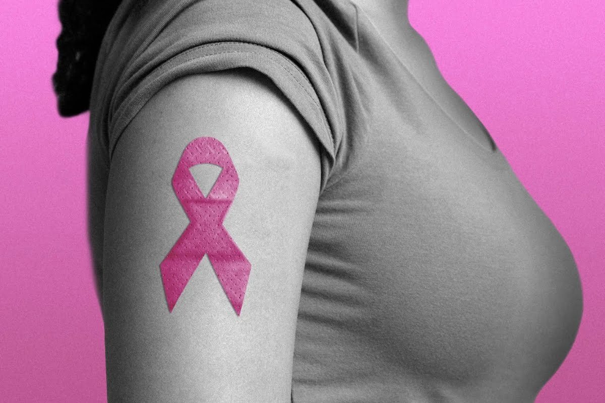 Roche's HER2 Powerhouse: Leading the Way in Breast Cancer Treatment