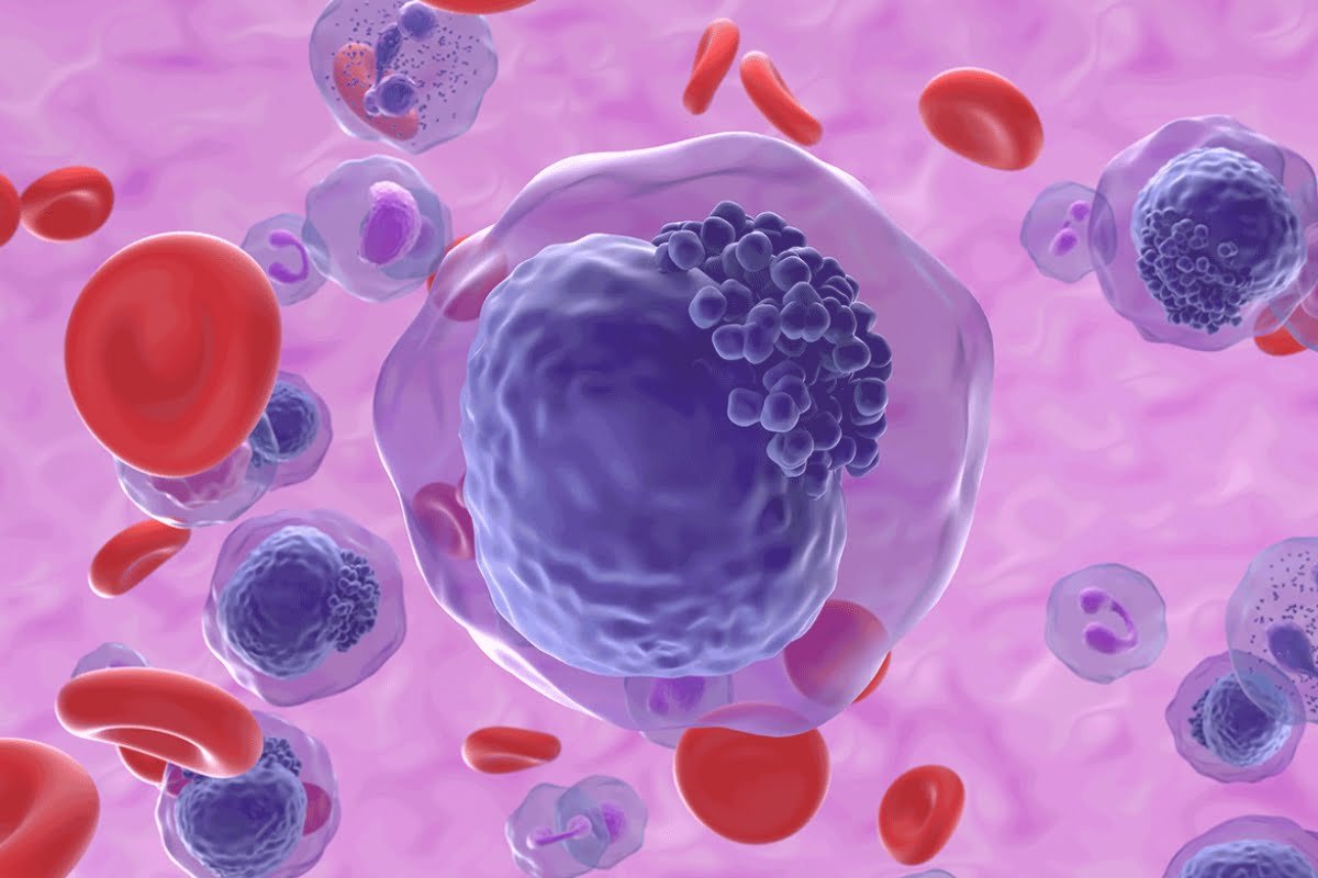 Trial of 2seventy Bio's AML cell treatment was put on hold following a death