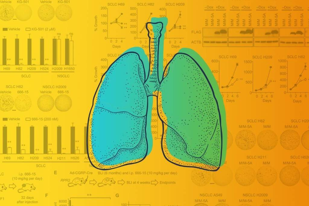 Datopotamab Deruxtecan Meets Dual Primary Endpoint in TROPION-Lung01 Phase III Trial for Advanced Non-Small Cell Lung Cancer - Pharmtales