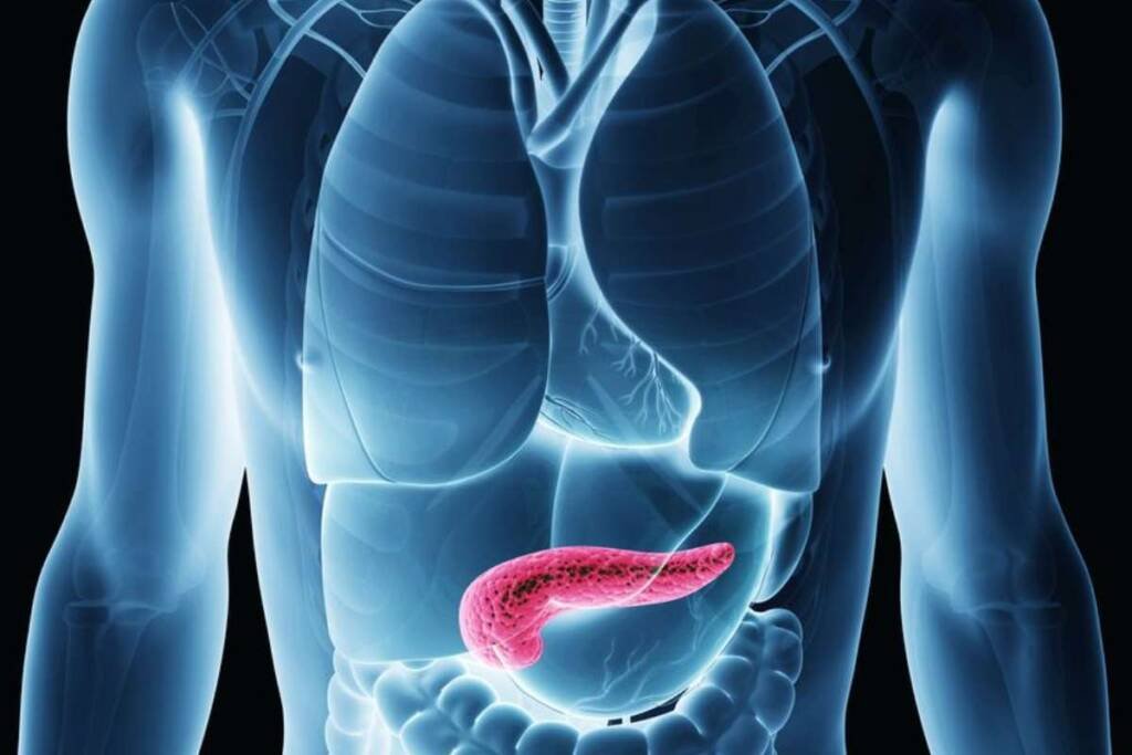 IA Gemcitabine Provides Survival Benefit in Patients with Locally Advanced Pancreatic Cancer
