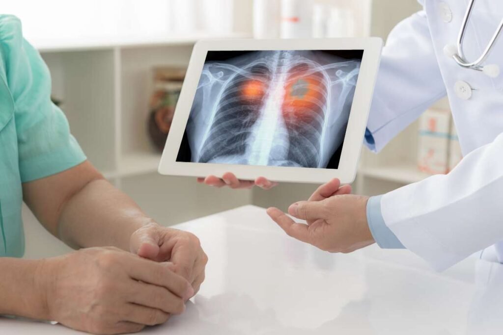 Symptoms Of Lung Cancer Stage 3, Lung Cancer Stage 3 Survival Rate , Lung Cancer Stage 3 - Pharmtales