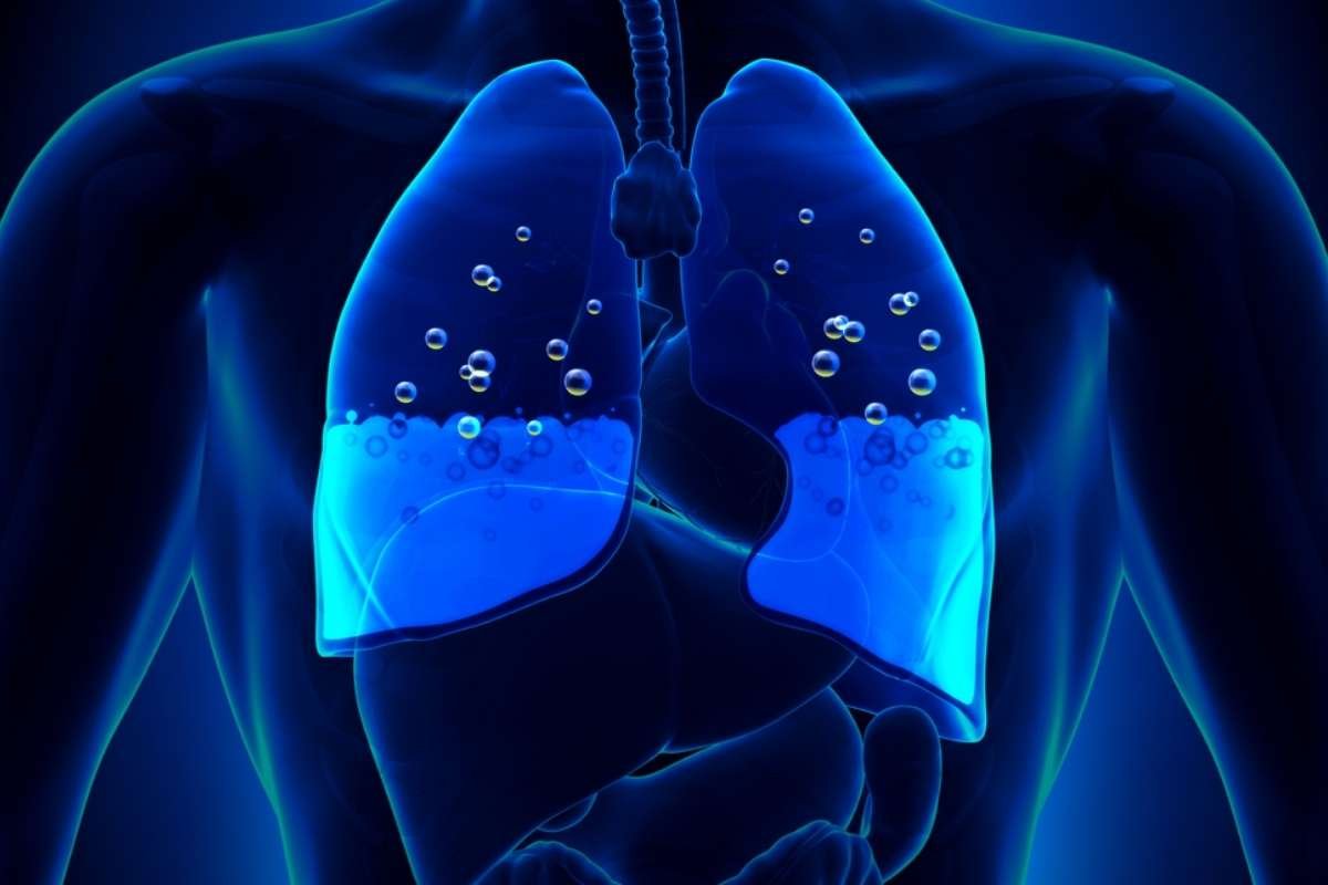 Teva Introduces a Smart Inhaler That Could Revolutionize Asthma Management