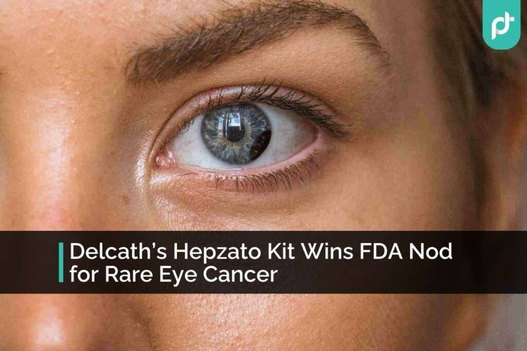 Hepzato Kit, Delcath, Eye cancer, FDA approval, Uveal Melanoma