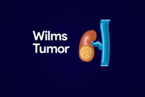 Wilms Tumor, what causes this rare disease, how it is diagnosed and treated, and the chances of recovery. You may also want to know about the latest research and emerging therapies for this