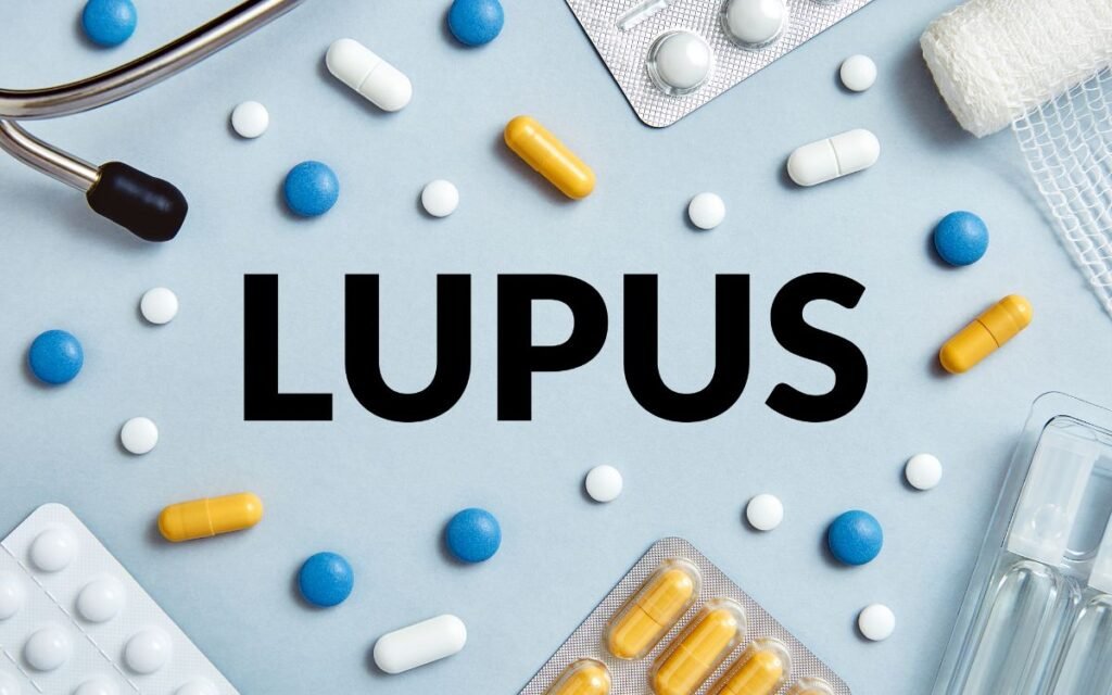 Nkarta’s cell therapy for lupus approved by FDA